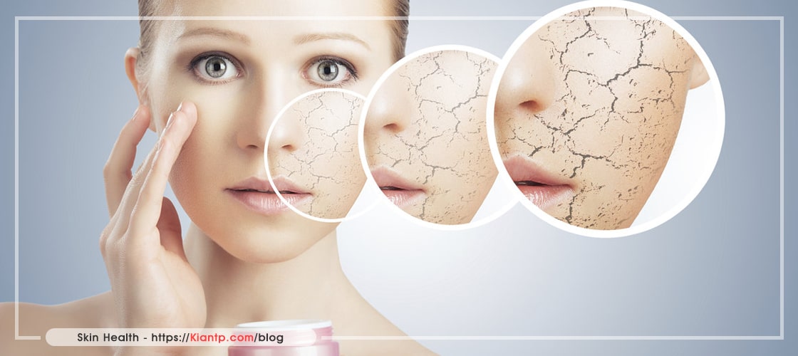 چهره زنی که یه قسمت از صورتش به نشانه خشکی صورت نشان داده شده که منظور از این است که باید مراقب پوست خود باشید